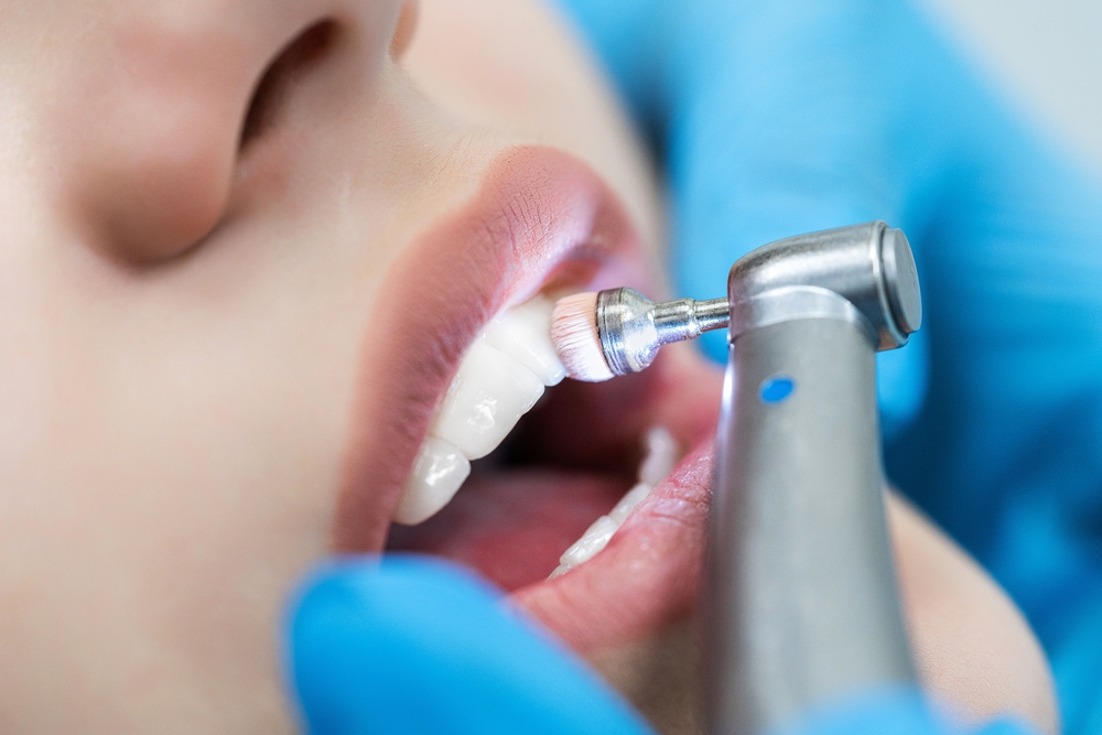 From Plaque to Polished: The Transformative Power of Professional Teeth Cleaning